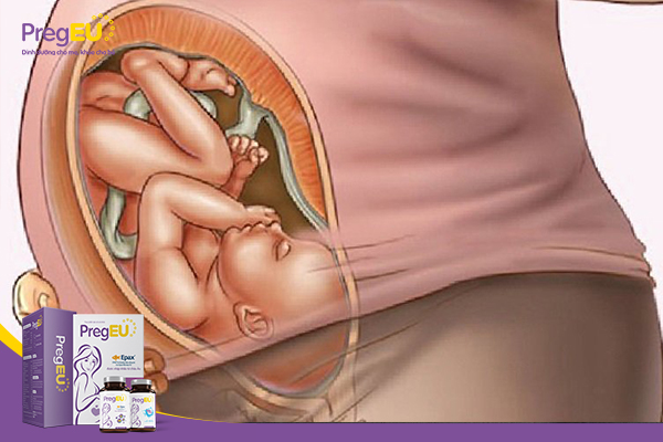 Mẹ bầu có thể tránh sinh mổ bằng cách nào?