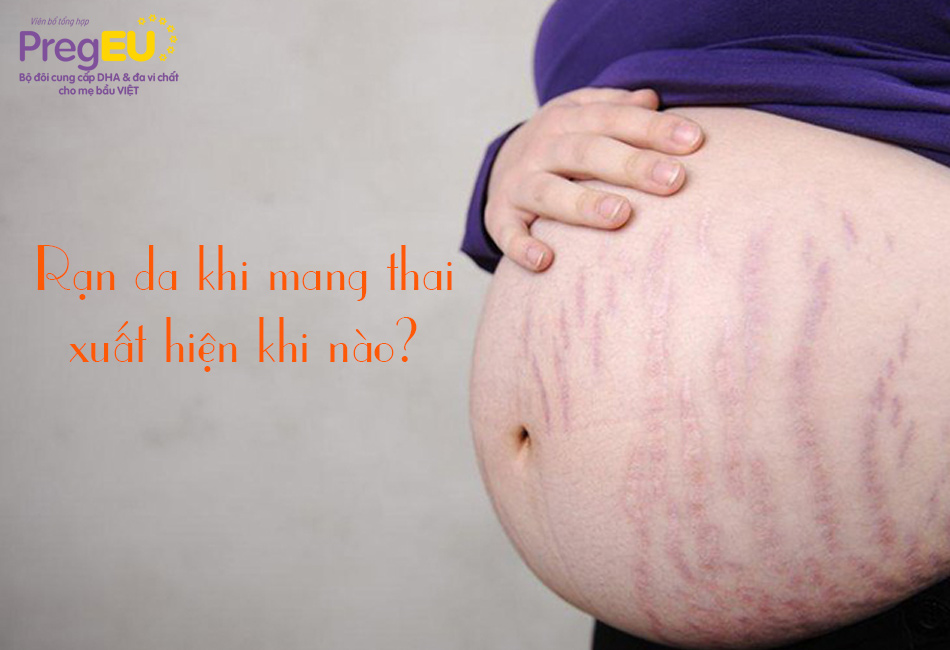 Rạn da khi mang thai xuất hiện khi nào?
