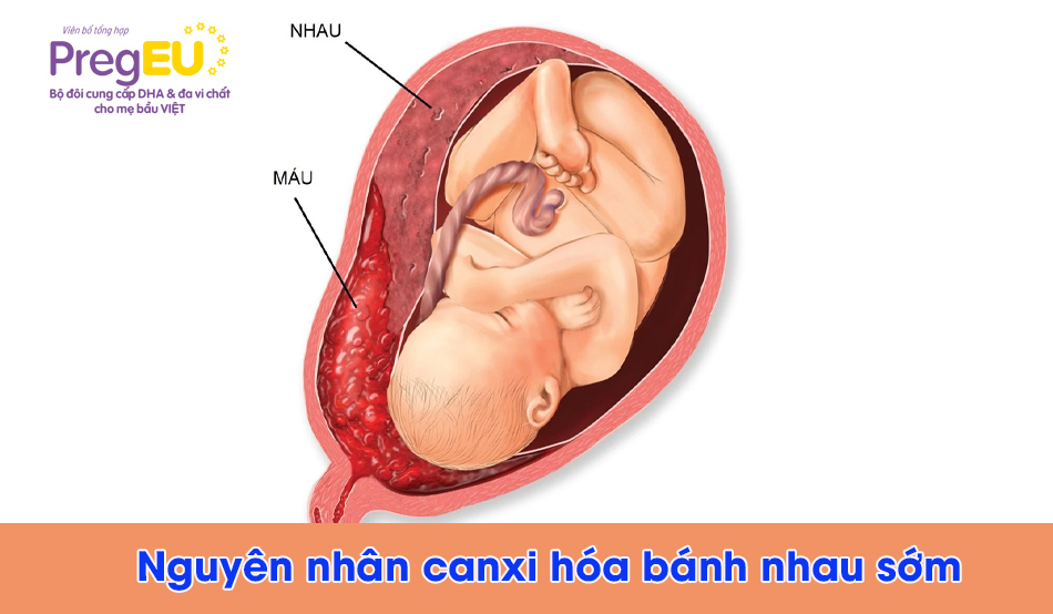 Canxi hóa bánh rau – những điều mẹ cần biết