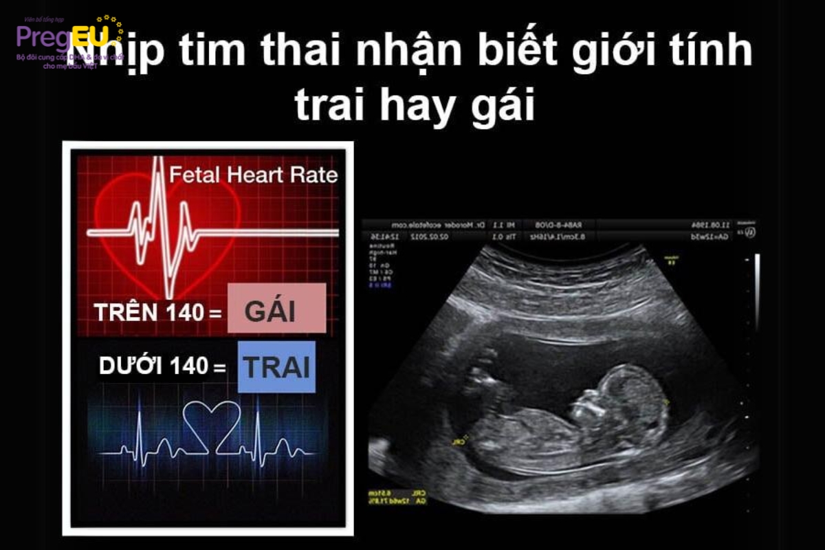 Nhịp tim em bé nhanh là dấu hiệu mang thai bé gái